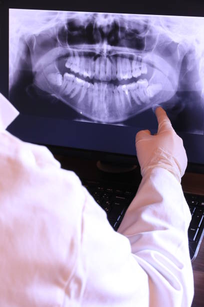 Best Chipped Tooth Repair Near Me  in Landen, OH