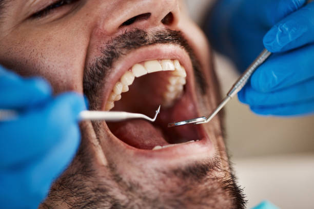 Best Emergency Tooth Extraction  in Landen, OH