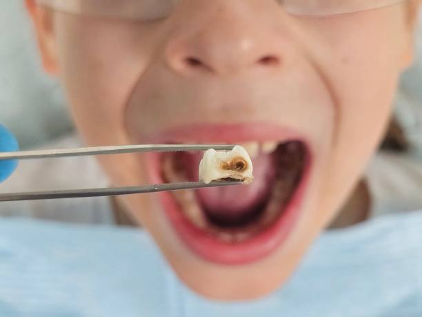 Best Emergency Gum Pain Relief  in Landen, OH